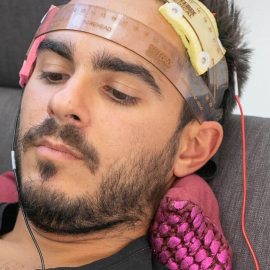 tDCS